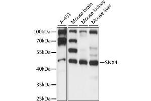Western blot analysis of extracts of various cell lines, using SNX4 antibody (ABIN7270504) at 1:1000 dilution.