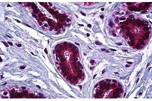 Human Breast: Formalin-Fixed, Paraffin-Embedded (FFPE) (IGF2R anticorps  (AA 2441-2490))