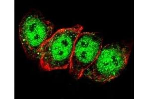 Confocal immunofluorescent analysis of Cyclin D1 antibody with HeLa cells followed by Alexa Fluor 488-conjugated goat anti-rabbit lgG (green).