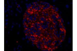 Immunohistochemistry (Paraffin-embedded Sections) (IHC (p)) image for anti-Chromogranin A (CHGA) (AA 348-463) antibody (ABIN1742517)