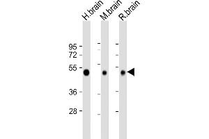 All lanes : Anti-NPTX1- Antibody at 1:2000 dilution Lane 1: human brain lysate Lane 2: mouse brain lysate Lane 3: rat brain lysate Lysates/proteins at 20 μg per lane.