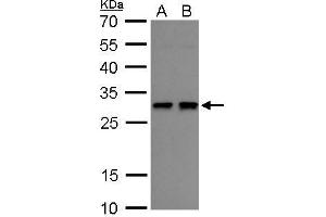 WB Image Heme Oxygenase 1 antibody detects Heme Oxygenase 1 protein by western blot analysis.