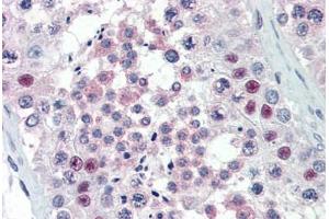 Human Testis (formalin-fixed, paraffin-embedded) stained with PRMT5 antibody ABIN337159 at 1:100 followed by biotinylated goat anti-rabbit IgG secondary antibody ABIN481713, alkaline phosphatase-streptavidin and chromogen. (PRMT5 anticorps)