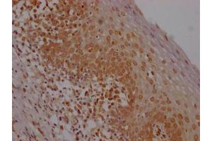 IHC image of ABIN7127462 diluted at 1:100 and staining in paraffin-embedded human tonsil tissue performed on a Leica BondTM system.