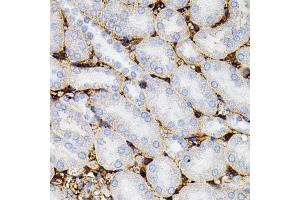 Immunohistochemistry of paraffin-embedded mouse kidney using MMP9 antibody (ABIN4904401) at dilution of 1:100 (40x lens). (MMP 9 anticorps)