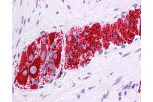 Anti-NR2E1 antibody IHC of human colon, myenteric plexus. (NR2E1 anticorps  (N-Term))