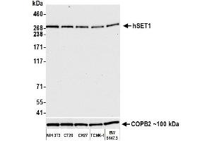 Western Blotting (WB) image for anti-hSET1 (AA 1200-1250) antibody (ABIN7454027)