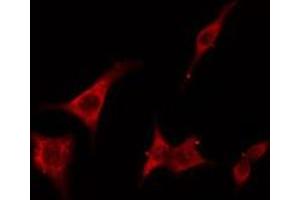 ABIN6275404 staining RAW264. (FNTB anticorps  (Internal Region))