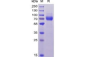 Human CD33, hFc-His Tag on SDS-PAGE under reducing condition.