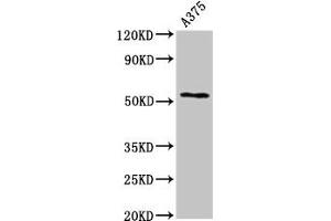 Western Blot Positive WB detected in: A375 whole cell lysate All lanes: CPE antibody at 2. (CPE anticorps  (AA 252-363))