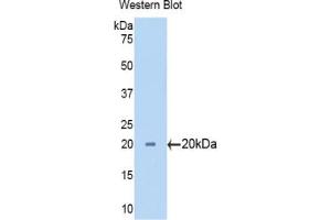 Western blot analysis of the recombinant protein. (CYP3A7 anticorps  (AA 344-497))