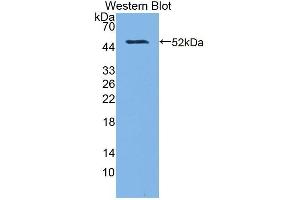 Detection of Recombinant MGMT, Rat using Polyclonal Antibody to O-6-Methylguanine DNA Methyltransferase (MGMT) (MGMT anticorps  (AA 1-209))