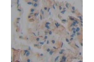 IHC-P analysis of Human Tissue, with DAB staining. (SFRP1 anticorps  (AA 32-314))