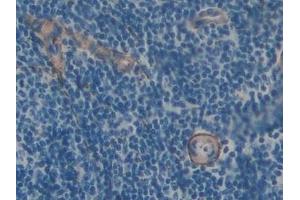 Detection of FBN1 in Rat Spleen Tissue using Polyclonal Antibody to Fibrillin 1 (FBN1)