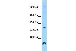 Host: Rabbit Target Name: C17orf108 Sample Type: Fetal Heart lysates Antibody Dilution: 1. (LYRM9 anticorps  (Middle Region))
