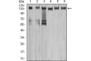 Western blot analysis using MET mouse mAb against A549 (1), COS7 (2), Hela (3), HEK293 (4), HepG2 (5), and A431 (6) cell lysate. (c-MET anticorps  (AA 743-932))
