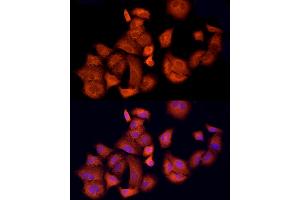Immunofluorescence analysis of A-549 cells using  Rabbit pAb (ABIN1678685, ABIN3015308, ABIN3015309 and ABIN6213977) at dilution of 1:150 (40x lens). (APAF1 anticorps  (AA 1-250))