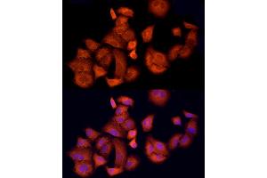 Immunofluorescence analysis of A-549 cells using  Rabbit pAb (ABIN1678685, ABIN3015308, ABIN3015309 and ABIN6213977) at dilution of 1:150 (40x lens). (APAF1 anticorps  (AA 1-250))