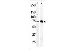 The anti-PKC beta2 Pab (ABIN391003 and ABIN2837938) is used in Western blot to detect PKC beta2 in Jurkat cell lysate (lane 1) and mouse brain tissue lysate (lane 2).