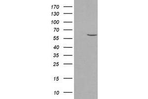 Western Blotting (WB) image for anti-Phosphoribosyl Pyrophosphate Amidotransferase (PPAT) (AA 42-278) antibody (ABIN1491504) (PPAT anticorps  (AA 42-278))