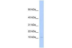 PLAC9 antibody used at 1 ug/ml to detect target protein. (PLAC9 anticorps  (Middle Region))