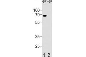 Western blot analysis of ETV5 antibody pre-incubated without (Lane 1) and with (2) blocking peptide in SW480 lysate