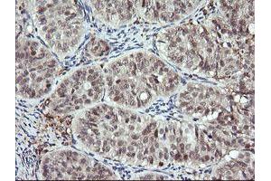 Image no. 2 for anti-Deleted in Primary Ciliary Dyskinesia Homolog (DPCD) antibody (ABIN1497889) (DPCD anticorps)