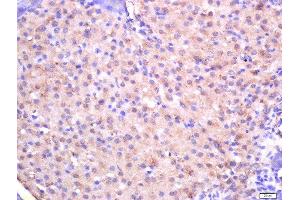 Formalin-fixed and paraffin embedded rat pancreas tissue labeled with Rabbit Anti-CTDSP2 Polyclonal Antibody, Unconjugated (ABIN2559702) at 1:200 followed by conjugation to the secondary antibody and DAB staining (CTDSP2 anticorps  (AA 25-150))