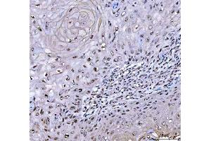 IHC analysis of RTCB using anti-RTCB antibody (ABIN7600722). (C22orf28 anticorps  (AA 227-505))