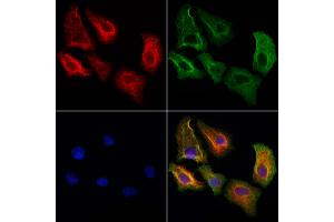 ABIN6264778 and ABIN6272928 staining Hela cells by IF/ICC.