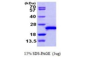 Figure annotation denotes ug of protein loaded and % gel used.