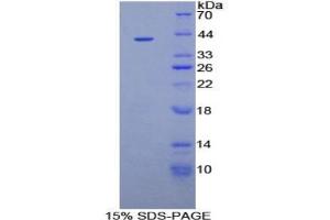 Rabbit Detection antibody from the kit in WB with Positive Control: Human placenta lysate. (IGFBPI Kit CLIA)