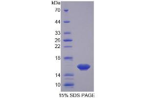 SDS-PAGE analysis of Mouse Osteoglycin Protein. (OGN Protéine)