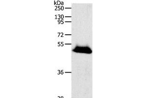Western Blot analysis of Human liver cancer tissue using RBMS3 Polyclonal Antibody at dilution of 1:1000 (RBMS3 anticorps)
