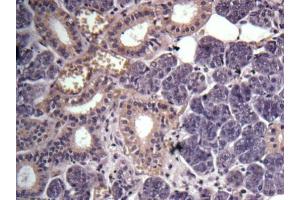 IHC-P Image Immunohistochemical analysis of human salivary gland cancer, using GPR114, antibody at 1:100 dilution.