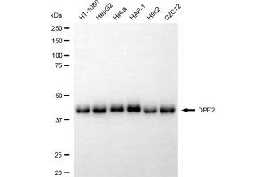 Western blotting analysis using DPF2 antibody (ABIN7800902).