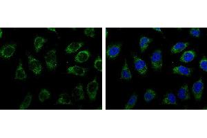 ICC/IF Image Triosephosphate isomerase antibody [C2C3], C-term detects Triosephosphate isomerase protein at cytoplasm by immunofluorescent analysis. (TPI1 anticorps  (C-Term))