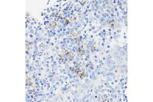 Immunohistochemistry of paraffin-embedded human tonsil using CAMP antibody (ABIN3022305, ABIN3022306, ABIN3022307, ABIN1512664 and ABIN6218724) at dilution of 1:200 (40x lens).