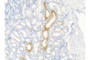 ABIN6256445 and ABIN6267615 at 1/100 staining human normal kidney tissue by IHC-P. (GRIN1/NMDAR1 anticorps  (pSer890))