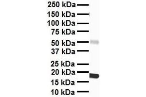 WB Suggested Anti-PPARA antibody Titration: 1 ug/mL Sample Type: Human heart (PPARA anticorps  (Middle Region))