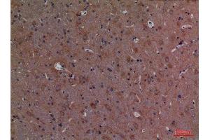 Immunohistochemistry (IHC) analysis of paraffin-embedded Rat Brain, antibody was diluted at 1:100.