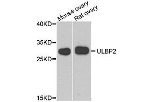 Western blot analysis of extract of mouse ovary and rat ovary cells, using ULBP2 antibody. (ULBP2 anticorps)