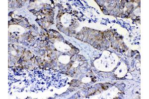 IHC analysis of PIK3CB using anti- PIK3CB antibody .