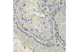 Immunohistochemistry of paraffin-embedded mouse testis using BUB1 Antibody.