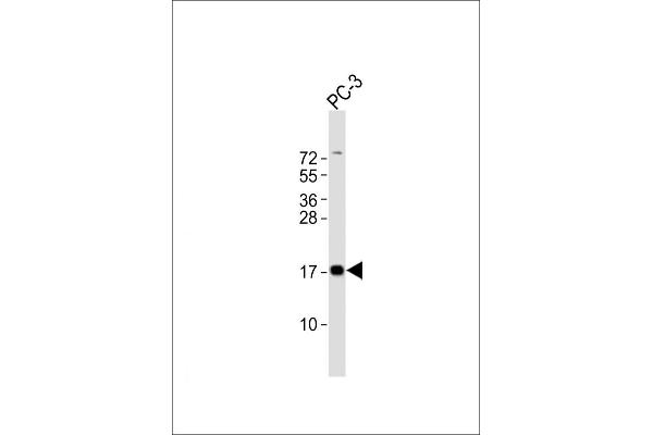 PLP2 anticorps  (C-Term)