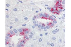 Anti-EP2 antibody IHC of human kidney.