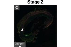 Immunohistological staining of artery tissues from diabetic subjects showing colocalization of serum proteins and mineral deposits.