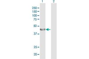 Western Blot analysis of ALG2 expression in transfected 293T cell line by ALG2 MaxPab polyclonal antibody.