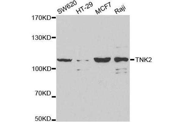 TNK2 anticorps  (AA 70-385)