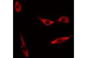 anti-Myosin, Light Chain 3 (MYL3) (Internal Region) antibody